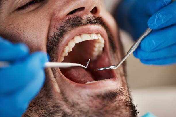 Best Pediatric Emergency Dentist in Groesbeck, OH